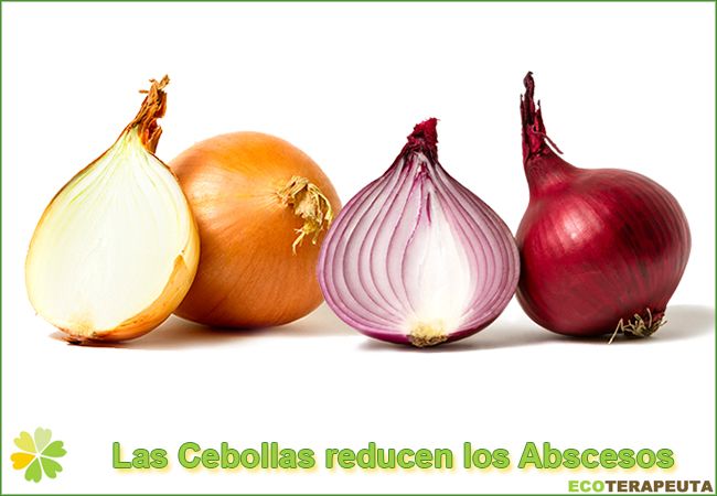 Cebollas para los abscesos